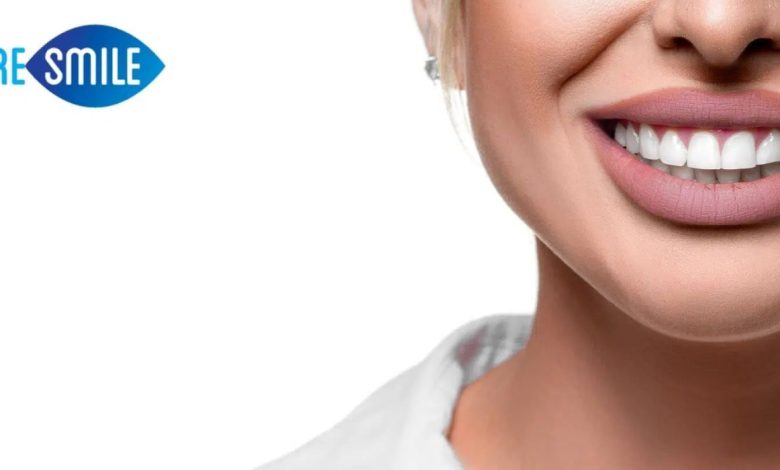 best teeth whitening in Melbourne