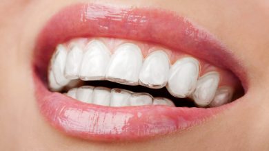 Invisalign Treatments