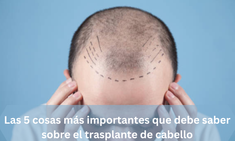 cuanto cuesta trasplante de cabello